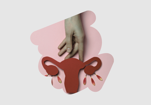 The Hidden Musculoskeletal Cost of Menopause